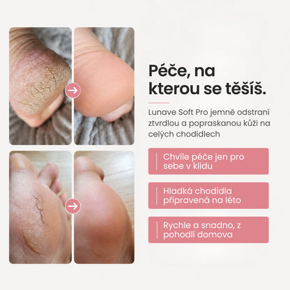 Lunave Soft Pro 2nd offer